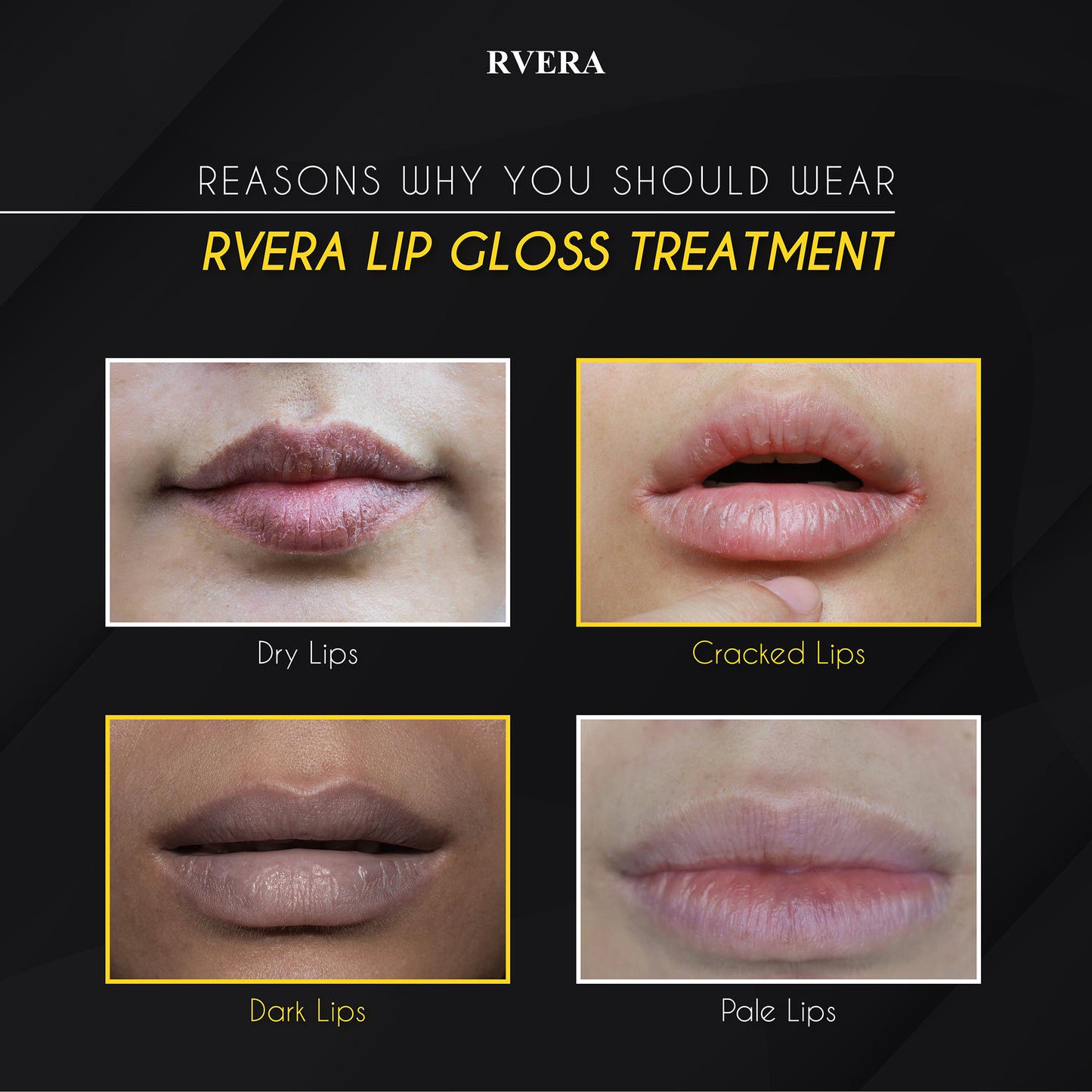 RVERA Glossy Lip Treatment